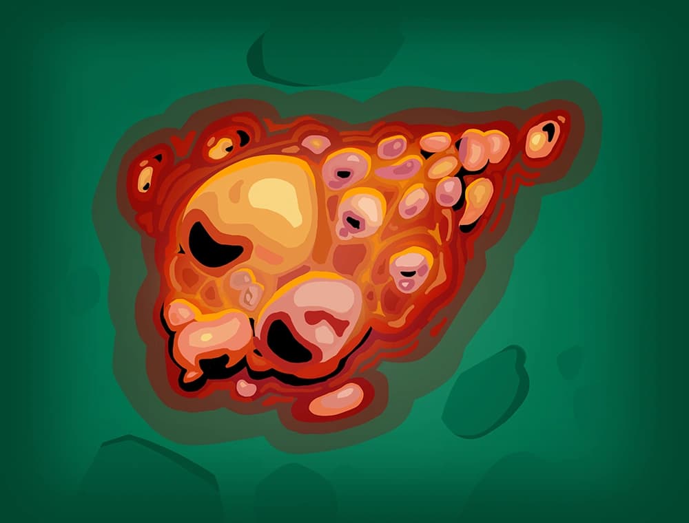 Burn - Slay the Spire 2 Card